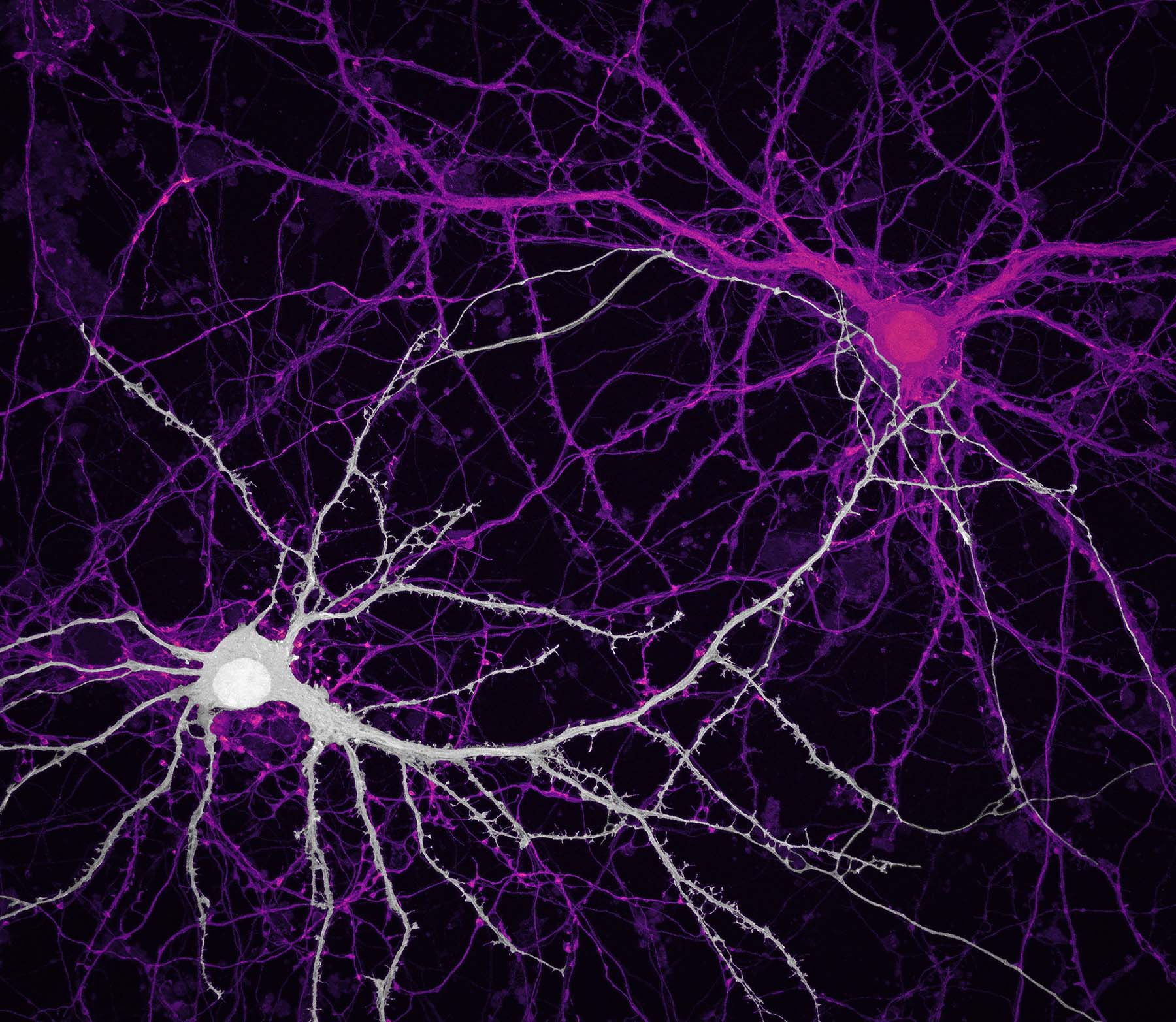 Connections between hippocampal neurons (brain cells) - Credit Jason Kirk Quynh Nguyen